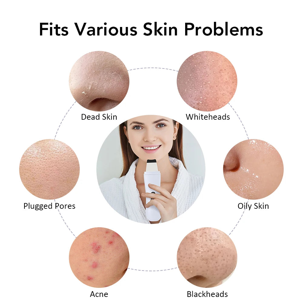 Ultrasonic Skin Scrubber – Deep Cleansing & Facial Care